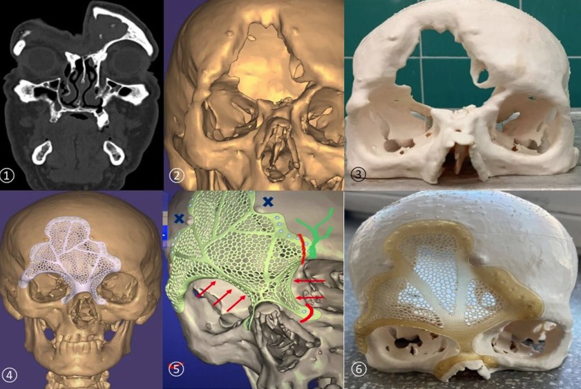 A modern technológia a gyógyítás szolgálatában